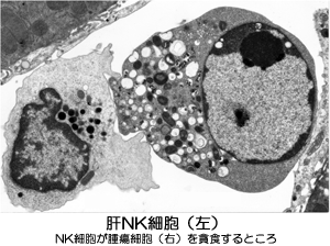 ナチュラル・キラー細胞